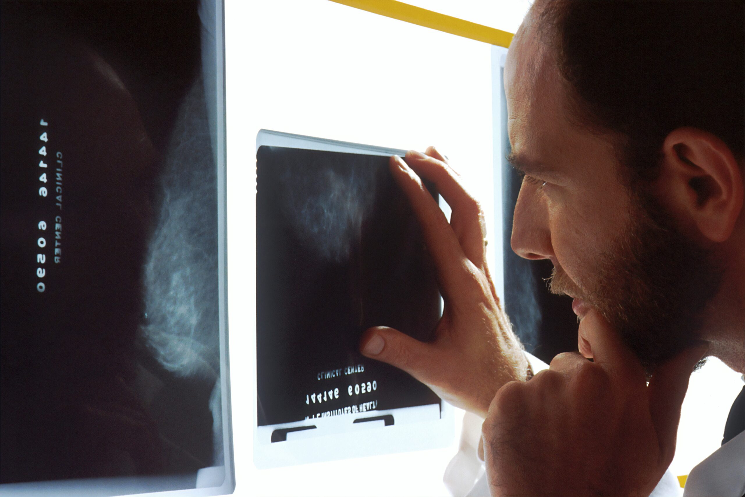 Quality Improvement Interventions to Reduce Anastomotic Leak - Evidence Based Reviews in Surgery